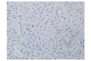 Immunohistochemistry validation image for anti-Wingless-Type MMTV Integration Site Family Member 2 (WNT2) (AA 221-320) antibody (ABIN762896)