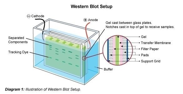 western blot vs southern blot