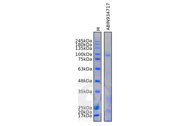 Thyroperoxidase Protéine