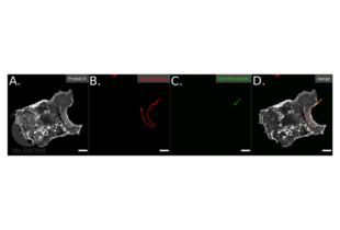 Immunofluorescence validation image for anti-Borrelia Burgdorferi antibody (ABIN236885) (Borrelia Burgdorferi anticorps)