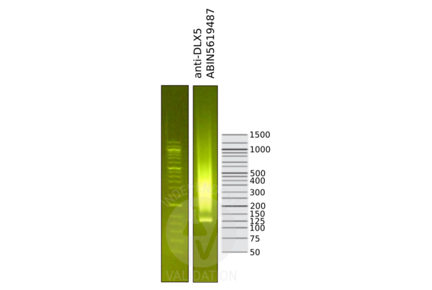 DLX5 anticorps  (Center)