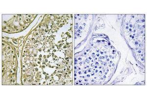 Immunohistochemistry (IHC) image for anti-Casein Kinase 1, alpha 1-Like (CSNK1A1L) (Internal Region) antibody (ABIN1849778) (CSNK1A1L anticorps  (Internal Region))