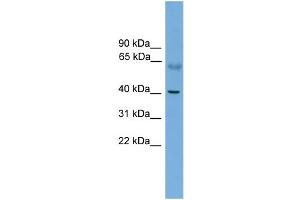 WB Suggested Anti-PRKACA Antibody Titration: 0. (PRKACA anticorps  (N-Term))