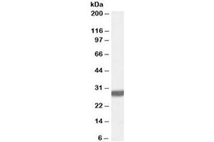 Western blot testing of rat brain lysate with Latexin antibody at 0. (Latexin anticorps)