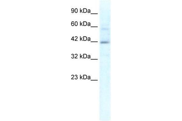 KCTD10 anticorps  (N-Term)