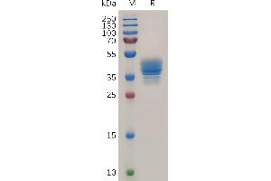 Human Protein, hFc Tag on SDS-PAGE under reducing condition. (CCR3 Protein (AA 1-34) (Fc Tag))
