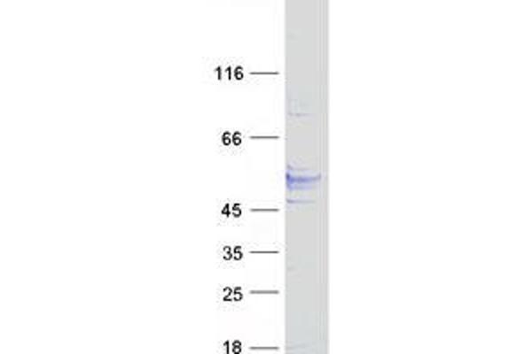 TMEM25 Protein (Transcript Variant 1) (Myc-DYKDDDDK Tag)