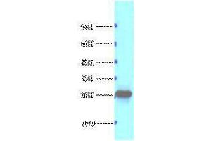 Western Blotting (WB) image for anti-B-Cell CLL/lymphoma 2 (BCL2) antibody (ABIN3178594) (Bcl-2 anticorps)