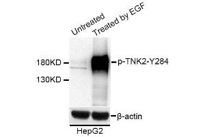 Western blot analysis of extracts of HepG2 cells, using Phospho-TNK2-Y284 antibody (ABIN5995622) at 1/1000 dilution. (TNK2 anticorps  (pTyr284))