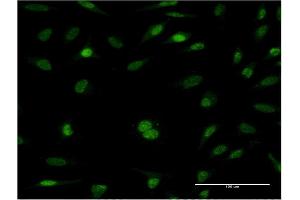 Immunofluorescence of monoclonal antibody to RFC5 on HeLa cell. (RFC5 anticorps  (AA 1-340))