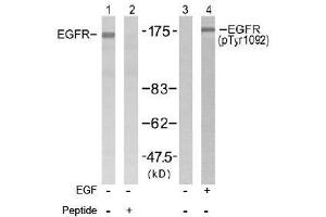 Image no. 2 for anti-Epidermal Growth Factor Receptor (EGFR) (Tyr1092) antibody (ABIN197231) (EGFR anticorps  (Tyr1092))