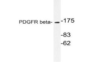 Western blot (WB)analyzes of PDGFR beta antibody in extracts from NIH/3T3 cells. (PDGFRB anticorps)