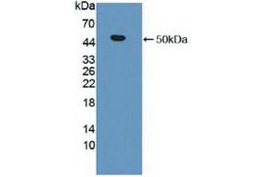 Western blot analysis of recombinant Human MMP19. (MMP19 anticorps  (AA 98-508))