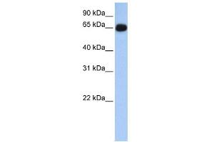 ALAS1 antibody used at 1 ug/ml to detect target protein. (ALAS1 anticorps  (N-Term))