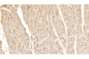 Detection of ADPN in Porcine Cardiac Muscle Tissue using Monoclonal Antibody to Adiponectin (ADPN) (ADIPOQ anticorps  (AA 18-243))