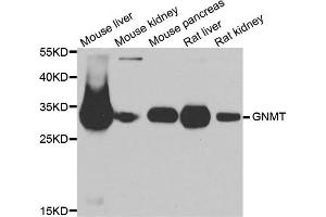 Western blot analysis of extracts of various cell lines, using GNMT antibody. (GNMT anticorps)