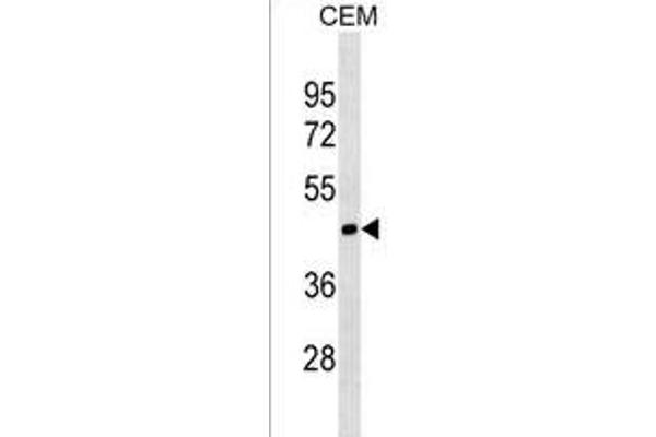MOCS1 anticorps  (N-Term)