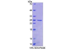 SDS-PAGE analysis of Human BCR Protein. (BCR Protéine)