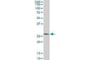 CNOT7 monoclonal antibody (M01A), clone 2F6. (CNOT7 anticorps  (AA 1-285))