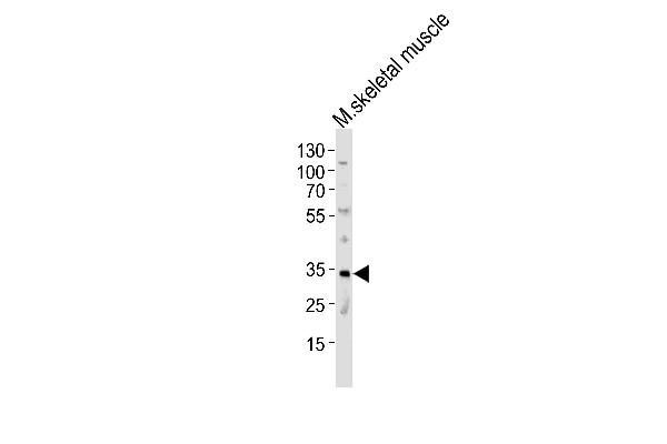 MOGAT2 anticorps  (C-Term)