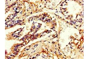 Immunohistochemistry of paraffin-embedded human lung tissue using ABIN7146632 at dilution of 1:100 (PDE4B anticorps  (AA 27-215))
