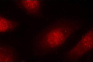 Immunofluorescence (IF) image for anti-Retinoblastoma 1 (RB1) (pSer780) antibody (ABIN1870571) (Retinoblastoma 1 anticorps  (pSer780))