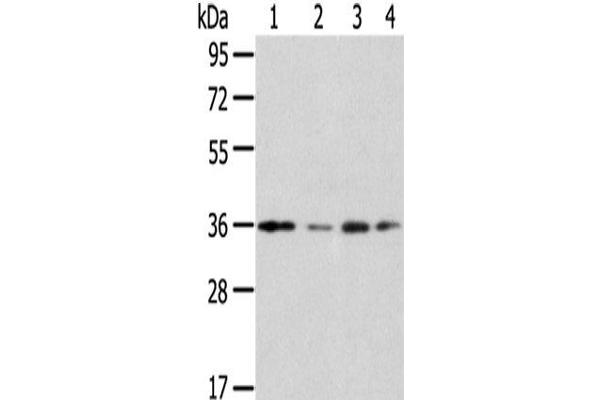 Homeobox D13 anticorps