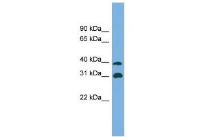 WB Suggested Anti-CRYM Antibody Titration: 0. (CRYM anticorps  (Middle Region))