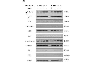 Western Blotting (WB) image for anti-Fas Ligand (TNF Superfamily, Member 6) (FASL) (AA 196-281) antibody (ABIN726410)