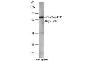 Western Blotting (WB) image for anti-Nuclear Factor-kB p65 (NFkBP65) (pSer536) antibody (ABIN730528)