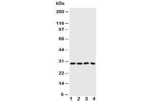 Western blot testing of Carbonic Anhydrase III antibody and Lane 1:  SMMC-7721 (CA3 anticorps  (N-Term))