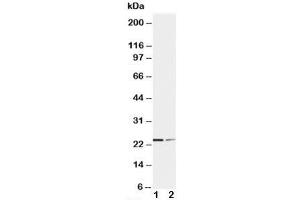 Western blot testing of SOCS1 antibody and Lane 1:  HT1080;  2: COLO320 cell lysate. (SOCS1 anticorps  (C-Term))