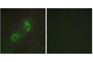 Immunofluorescence analysis of HUVEC cells, using HGS antibody. (HGS anticorps  (Internal Region))