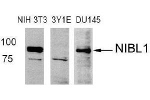 Western blot analysis of extract from NIH3T3 (Mouse), 3Y1E (Rat), DU145 (Human) cells using Niban like protein 1(Ab-712) antibody (E021332). (MEG3 anticorps)