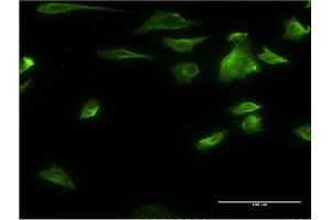 Immunofluorescence of monoclonal antibody to HDAC6 on HeLa cell. (HDAC6 anticorps  (AA 1-1063))