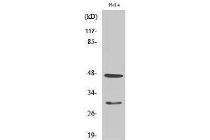Western Blotting (WB) image for anti-Cathepsin D (CTSD) (Internal Region) antibody (ABIN3174201) (Cathepsin D anticorps  (Internal Region))