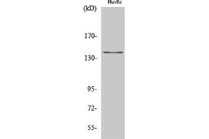 Western Blot analysis of HuvEc cells using Amyloid-β Polyclonal Antibody diluted at 1:2000. (beta Amyloid anticorps)