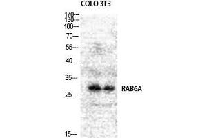 Western Blot (WB) analysis of COLO205 NIH-3T3 cells using Rab 6A Polyclonal Antibody. (RAB6A anticorps  (Internal Region))