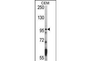 Western blot analysis of hHDAC7-A935 in CEM cell line lysates (35ug/lane) (HDAC7 anticorps  (C-Term))