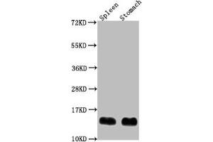 Western Blot Positive WB detected in: Mouse spleen tissue, Mouse stomach tissue All lanes: B2m antibody at 1:2000 Secondary Goat polyclonal to rabbit IgG at 1/50000 dilution Predicted band size: 14 kDa Observed band size: 14 kDa (beta-2 Microglobulin anticorps  (AA 21-119))