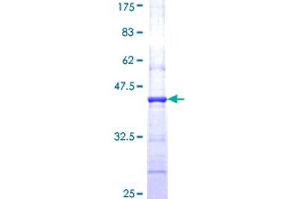 Cofilin 2 Protein (CFL2) (AA 57-166) (GST tag)