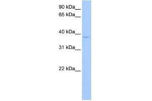 RPL3 antibody used at 1 ug/ml to detect target protein. (RPL3 anticorps  (C-Term))