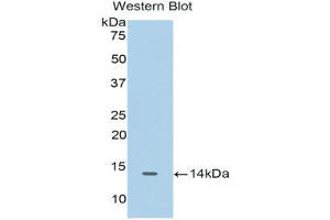 Western Blotting (WB) image for anti-Cyclin-Dependent Kinase 2 (CDK2) (AA 94-198) antibody (ABIN1175171) (CDK2 anticorps  (AA 94-198))