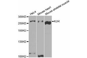 Western blot analysis of extracts of various cell lines, using KDR antibody (ABIN5973267) at 1/1000 dilution. (VEGFR2/CD309 anticorps)
