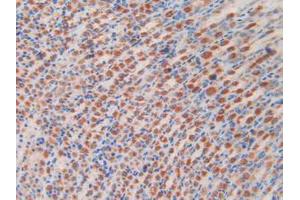 IHC-P analysis of Rat Stomach Tissue, with DAB staining. (2B4 anticorps  (AA 20-221))