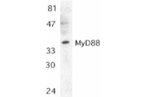 Image no. 1 for anti-Myeloid Differentiation Primary Response Gene (88) (MYD88) (AA 279-296), (C-Term) antibody (ABIN205874) (MYD88 anticorps  (C-Term))