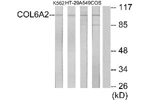 Immunohistochemistry analysis of paraffin-embedded human lung carcinoma tissue using Collagen VI α2 antibody. (COL6A2 anticorps)