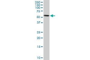 Western Blotting (WB) image for anti-ERO1-Like Protein alpha (ERO1L) (AA 90-179) antibody (ABIN599232) (ERO1L anticorps  (AA 90-179))