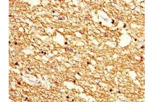 Immunohistochemistry of paraffin-embedded human brain tissue using ABIN7142178 at dilution of 1:100 (Cnpase anticorps  (AA 226-415))