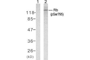 Western blot analysis of extracts from K562 cells untreated or treated with 10% serum after 48 hours of starvation, using Rb (phospho-Ser795) antibody (E011130). (Retinoblastoma 1 anticorps  (pSer795))
